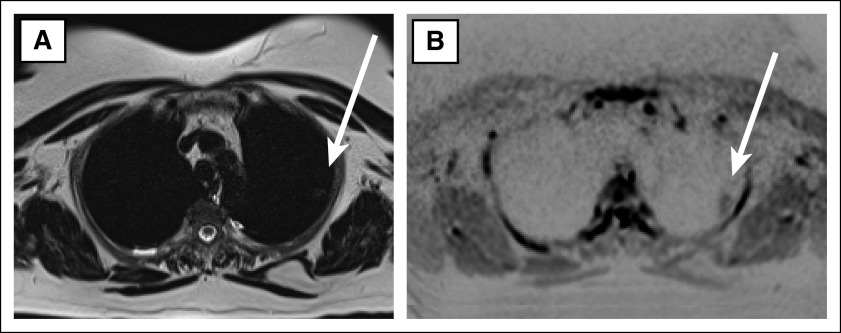 FIG 2.