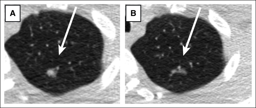 FIG 1.