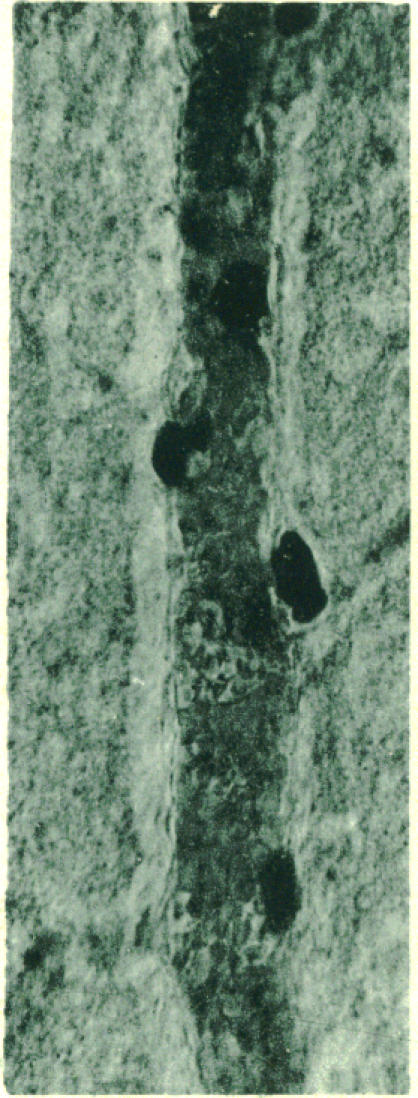 Photomicrograph XI