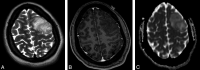 Fig 1.