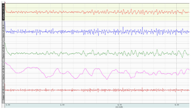 Figure 17