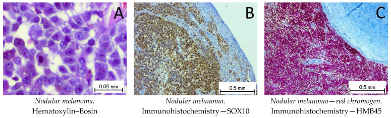 Figure 13