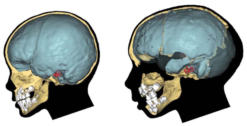 FIGURE 2