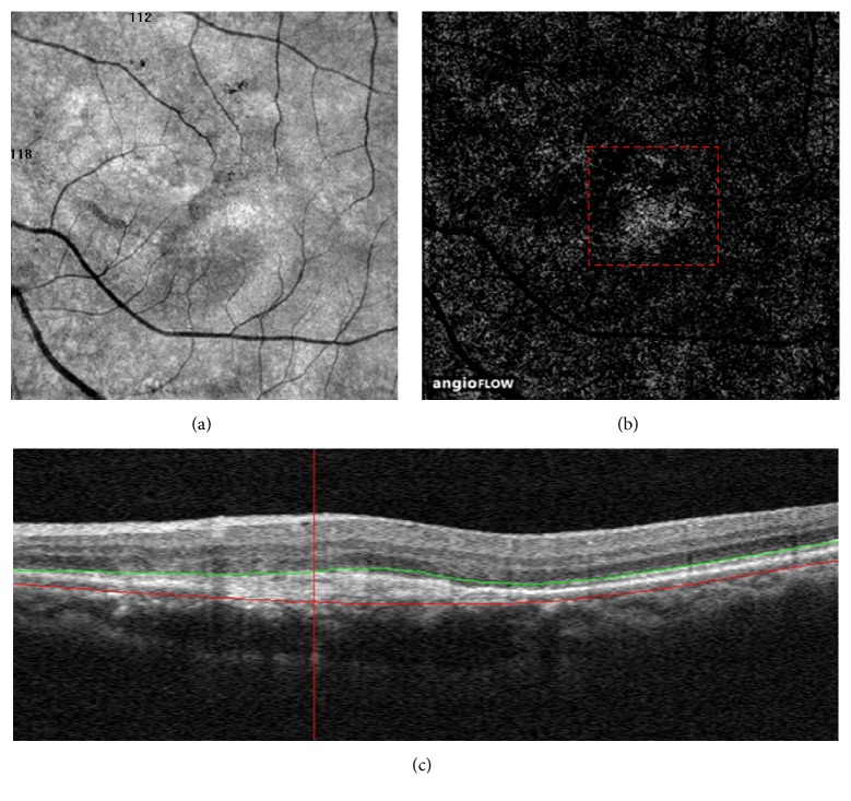 Figure 2