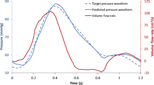 The in-house optimization algorithm outputs unique values of resistances and capacitance for the flowrate and target pressure waveforms. The predicted pressure waveform represents the resultant pressure calculated using these optimized values. The relative error between the target and predicted pressure waveforms was 1.97%.