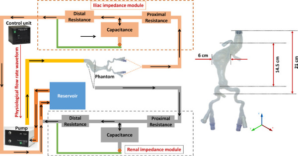 Schematic representing the benchtop flow loop built using the deformable silicone AAA phantom. The programmable pump supplies a physiological flow waveform to the AAA phantom, while the renal and iliac impedance modules recreate physiological impedance provided by the peripheral arterial system. This is experimental setup 4 described in Sec.2.2.3.2. The inset illustrates basic dimensions of the phantom.