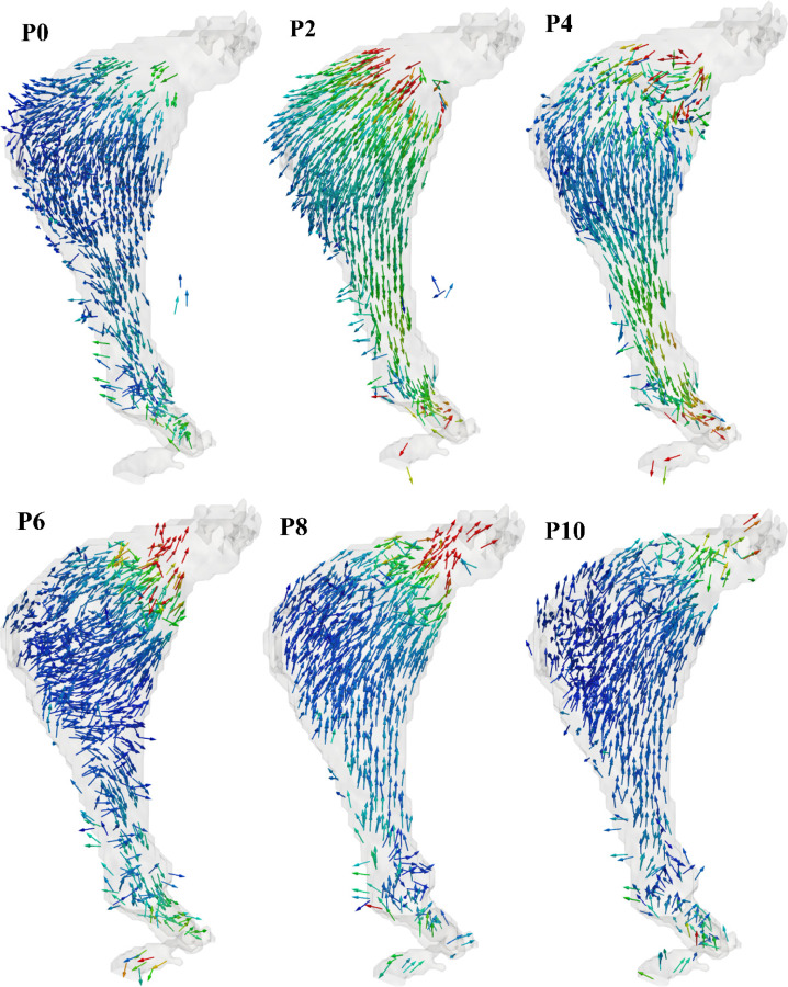 Temporal variation of the velocity field within the AAA phantom measured by phase-contrast MRI. Phases P0 through P18 correspond to ten of the twenty phases of the pulsatile cycle acquired during MR imaging.