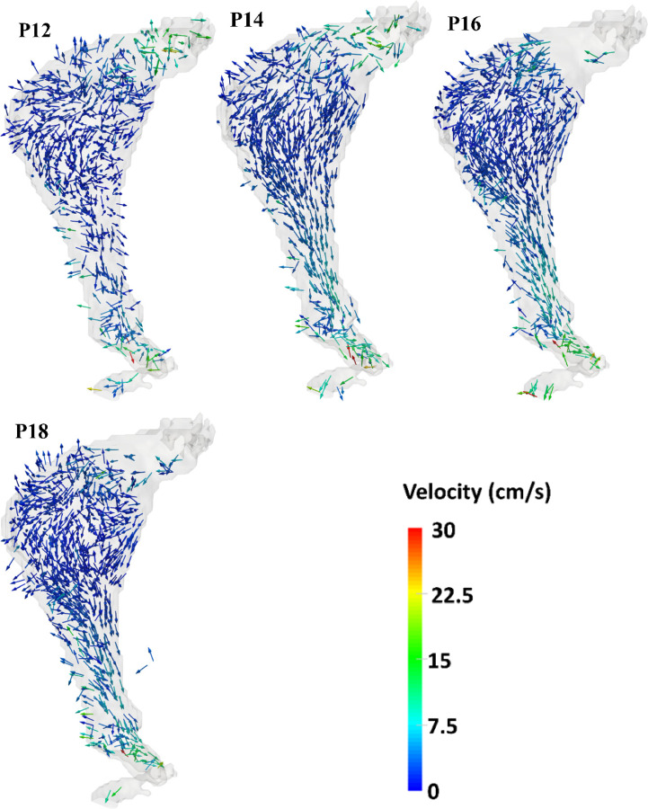 Temporal variation of the velocity field within the AAA phantom measured by phase-contrast MRI. Phases P0 through P18 correspond to ten of the twenty phases of the pulsatile cycle acquired during MR imaging.