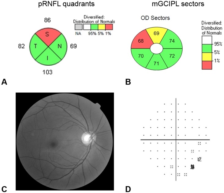 Fig 1