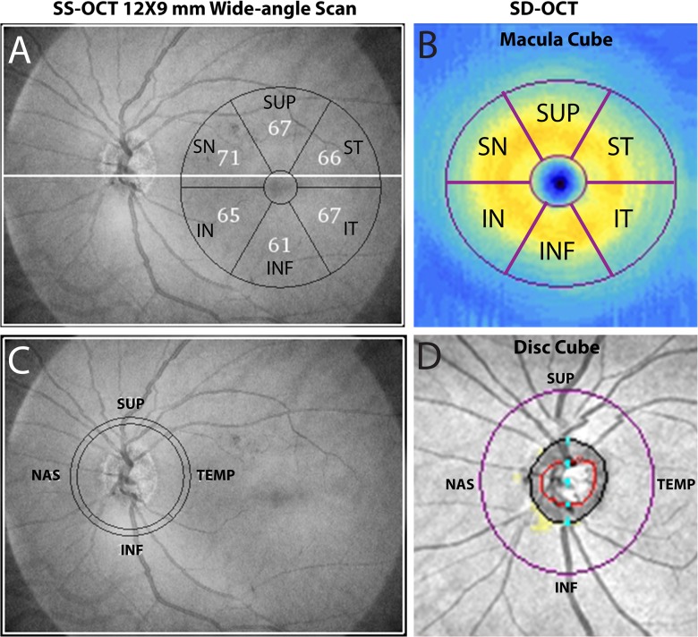 Fig 1