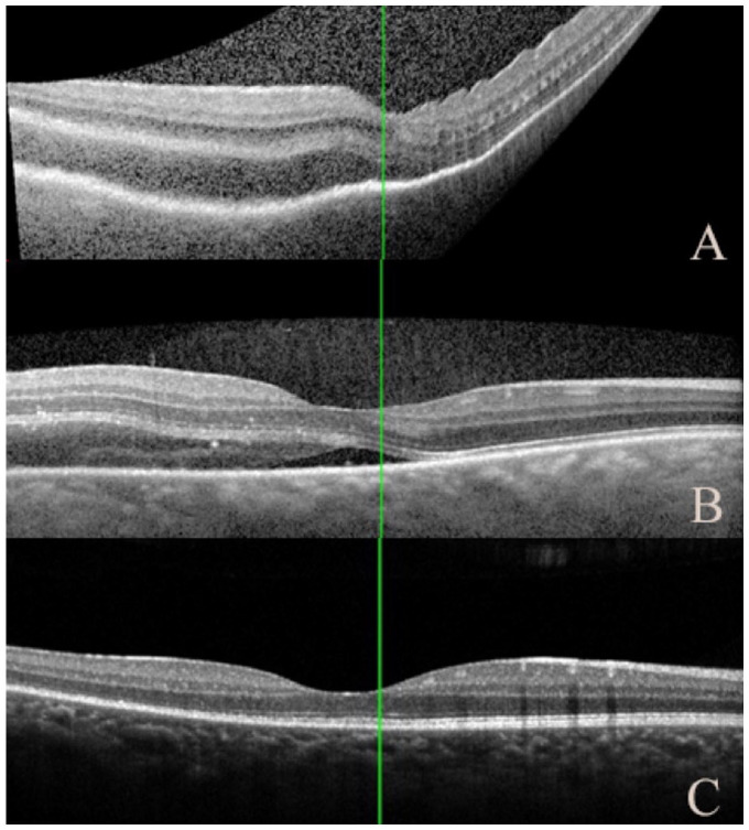 Figure 2.