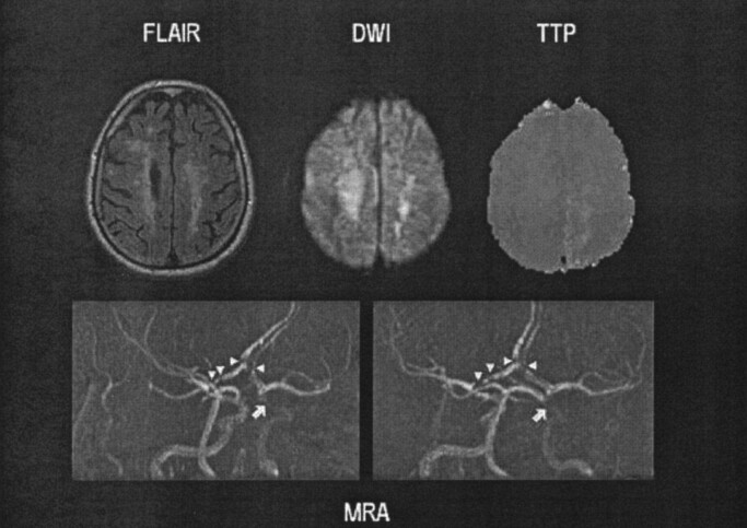 Fig 3.