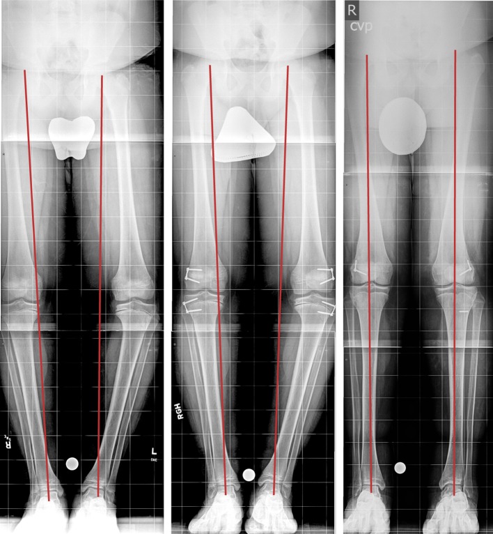 Fig. 3