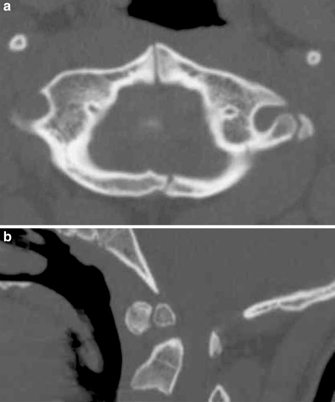 Fig. 2