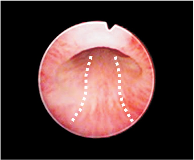 Fig. 5