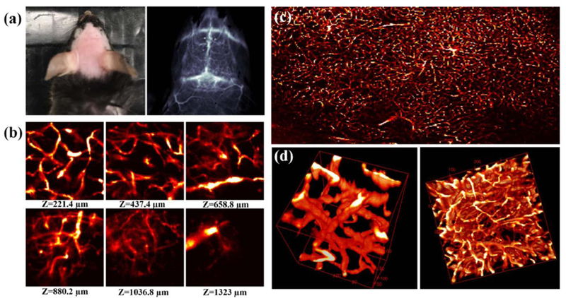 Figure 11.