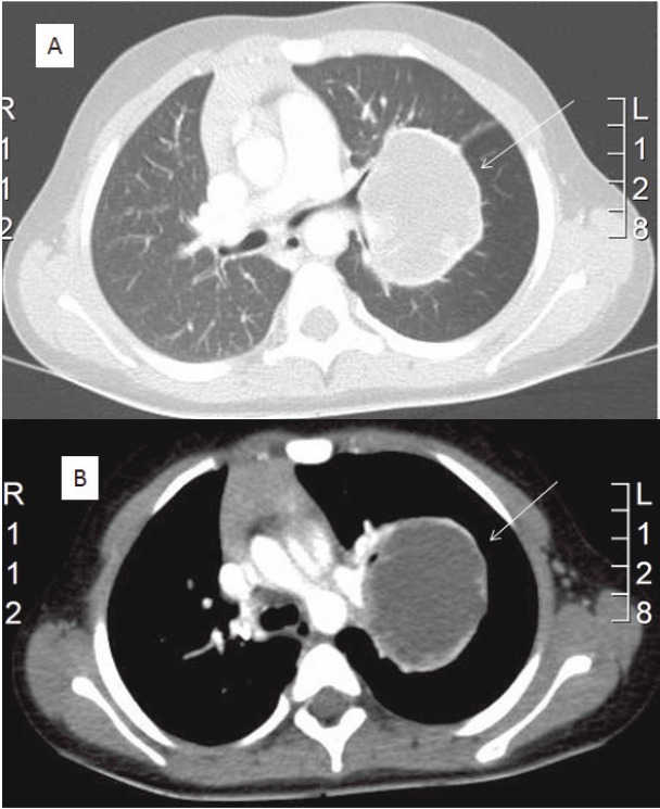 Figure 2: