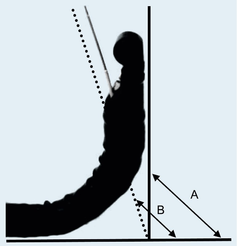 Fig. 2