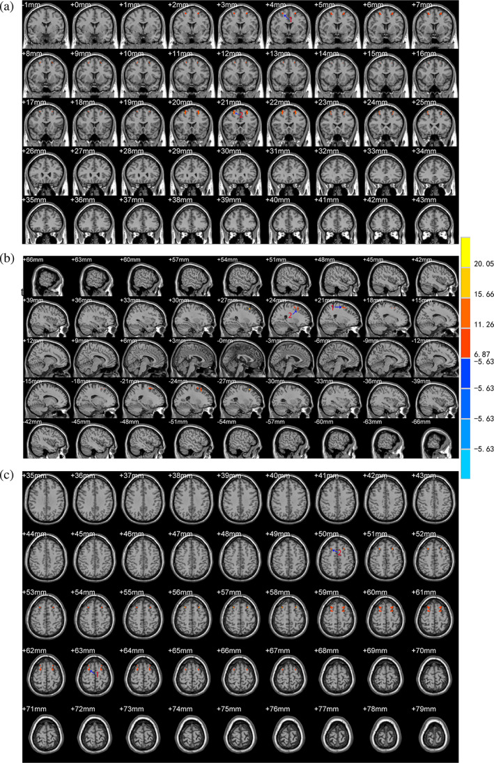 FIGURE 2