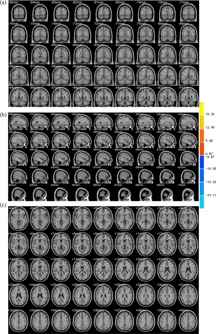 FIGURE 3