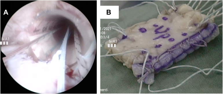 Figure 3