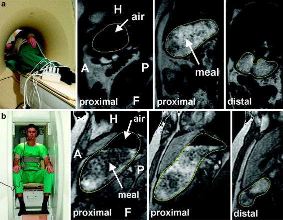 Fig. 4