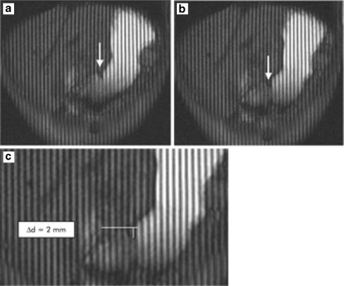 Fig. 3