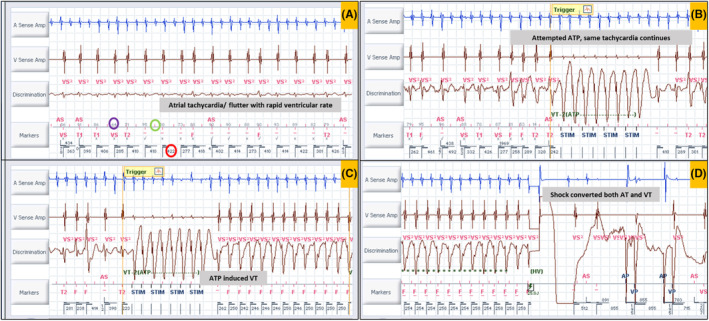 FIGURE 2