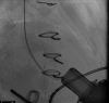 Fig. 11.