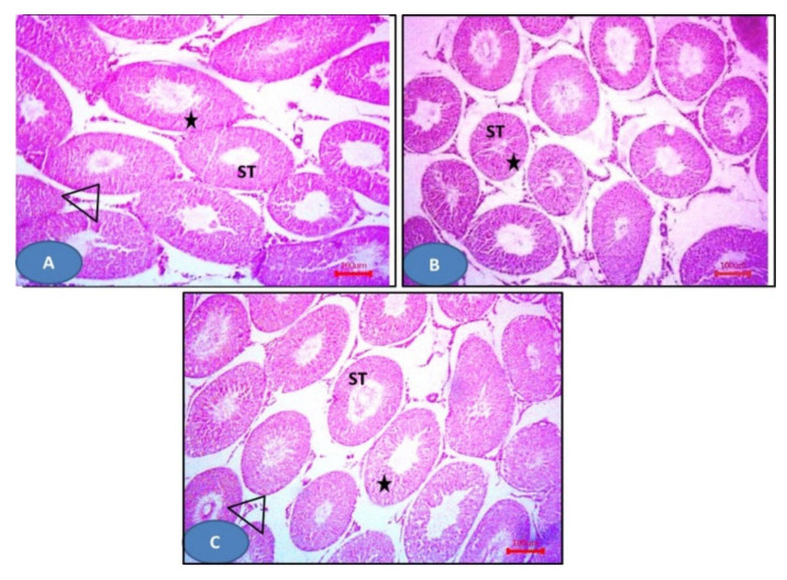 Figure 11