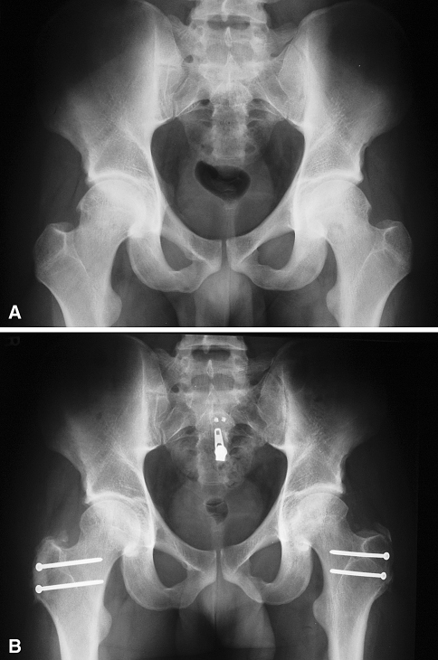 Fig. 1A–B