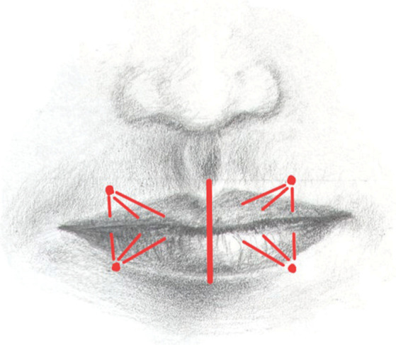 Figure 2: