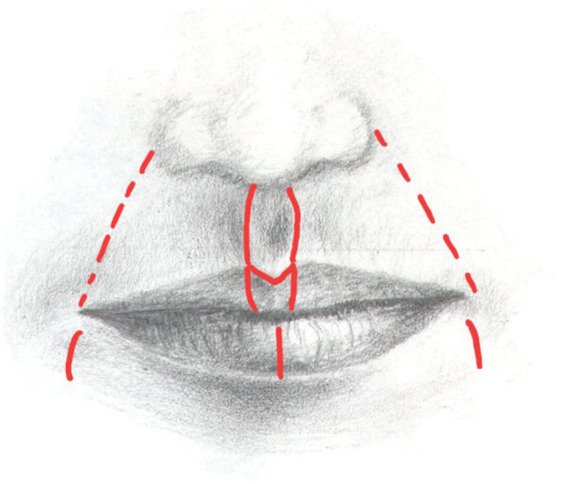 Figure 1: