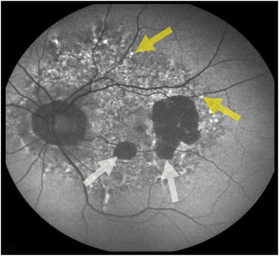 Fig. 4.