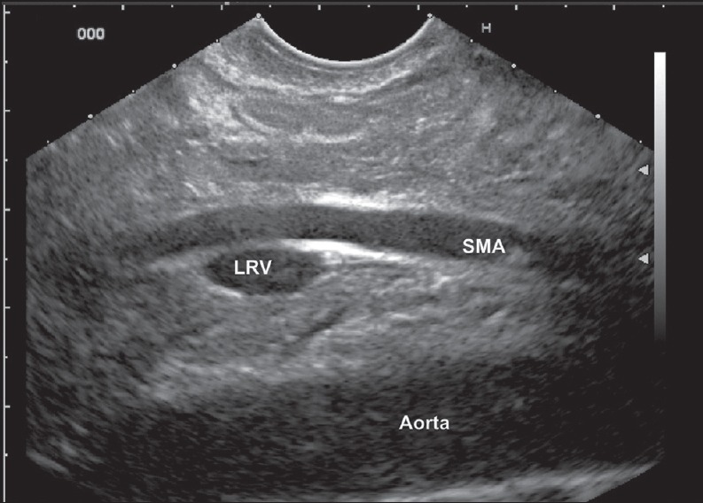 Figure 26