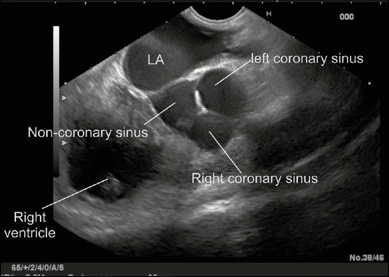 Figure 2b