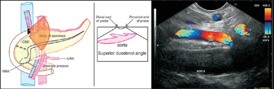 Figure 29