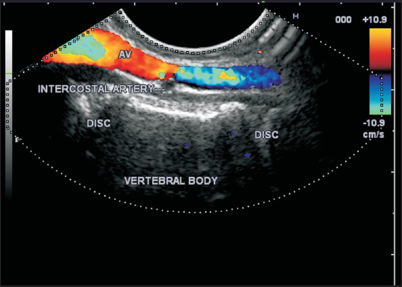 Figure 19