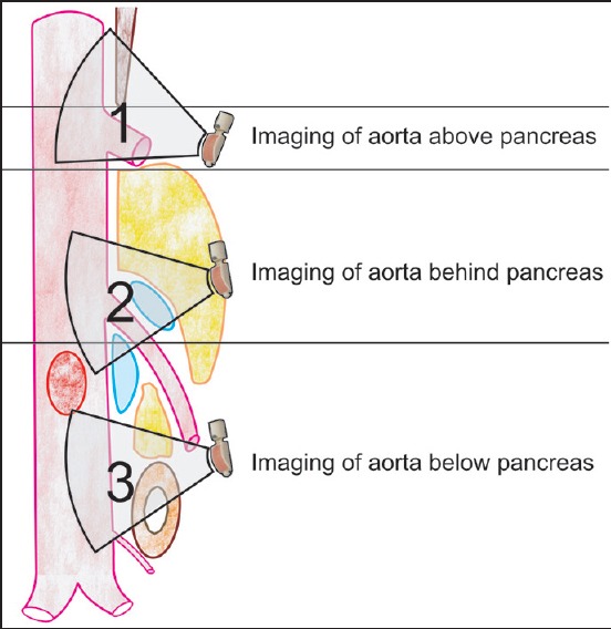 Figure 20