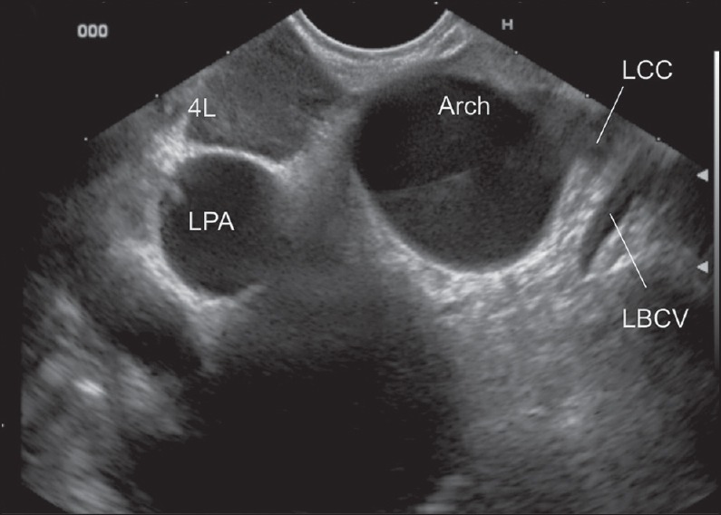 Figure 14