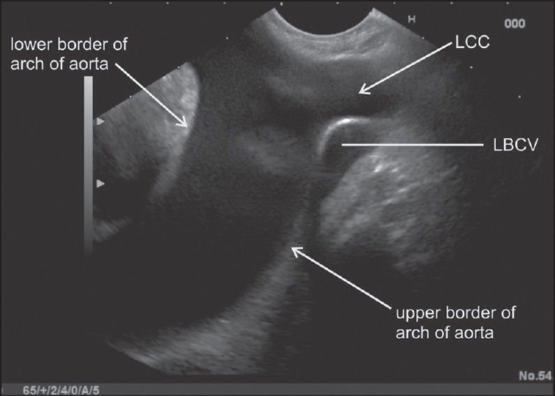 Figure 11