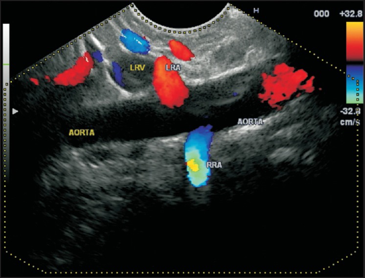 Figure 31