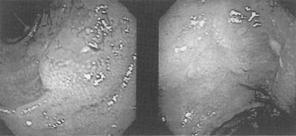 Figure 15-2.