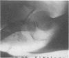 348-1
