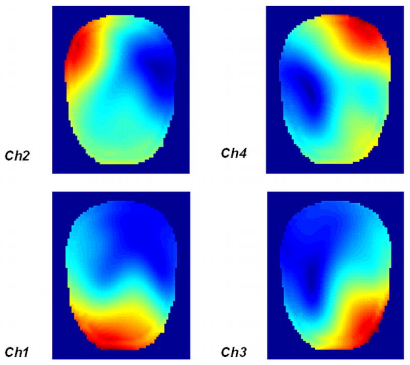 Figure 12