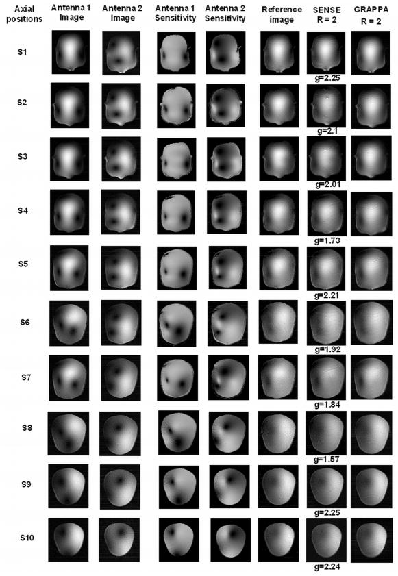 Figure 14