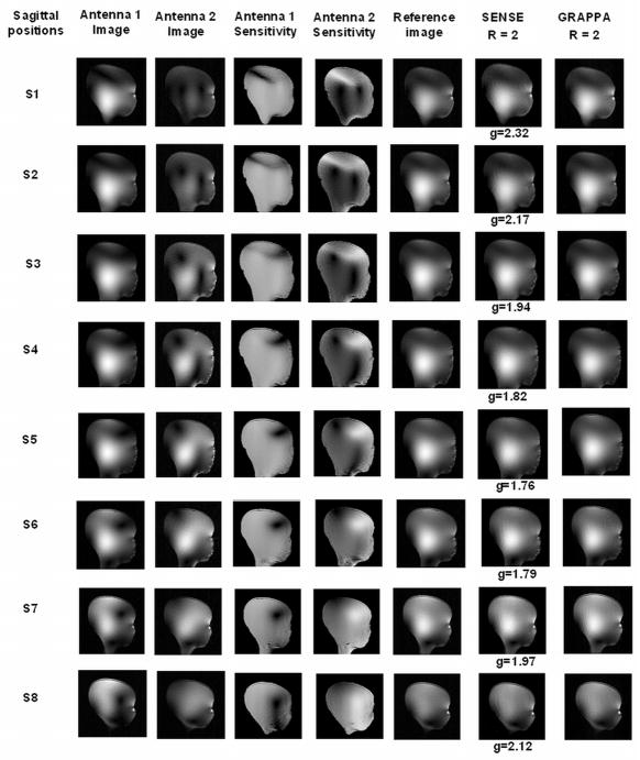 Figure 15