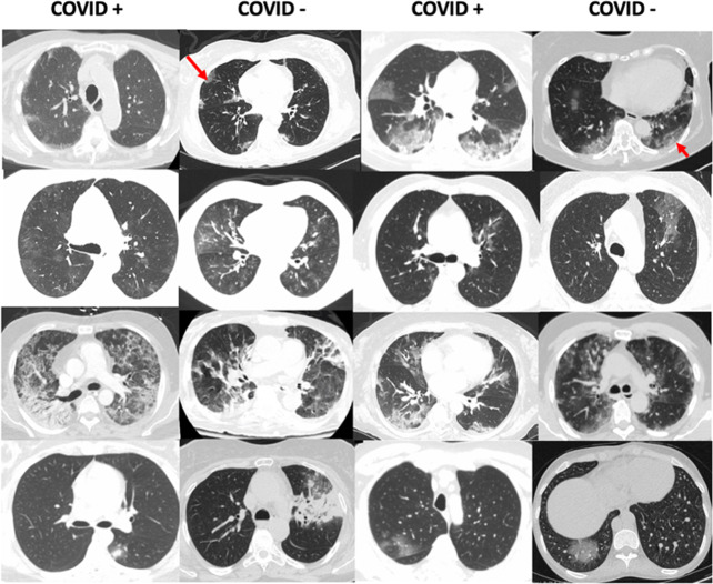 Fig. 13