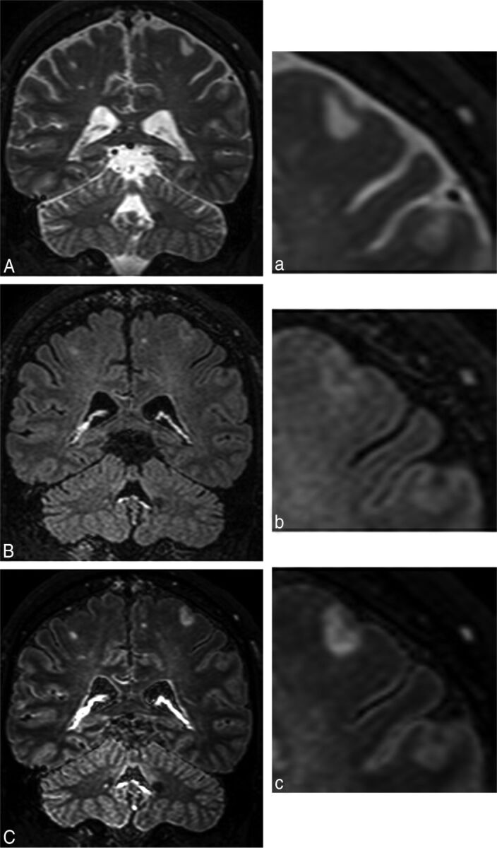 Fig 3.