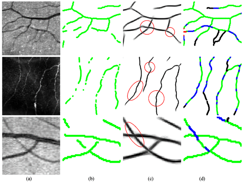 Fig. 14.